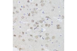 Immunohistochemistry of paraffin-embedded rat brain using PPP1CC antibody at dilution of 1:100 (x40 lens). (PPP1CC 抗体)
