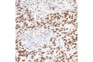 Immunohistochemistry (IHC) image for anti-Metastasis Associated 1 (MTA1) (C-Term) antibody (ABIN7454687) (MTA1 抗体  (C-Term))