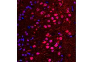 Immunofluorescence (Paraffin-embedded Sections) (IF (p)) image for anti-Wolf-Hirschhorn Syndrome Candidate 1-Like 1 (WHSC1L1) antibody (ABIN7076233)