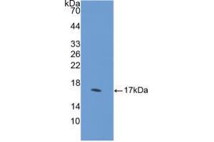 Western blot analysis of recombinant Human DHH. (desert Hedgehog 抗体  (AA 241-383))