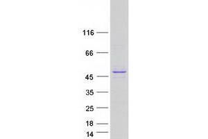 Western Blotting (WB) image for SWI/SNF Related, Matrix Associated, Actin Dependent Regulator of Chromatin, Subfamily B, Member 1 (SMARCB1) (Transcript Variant 2) protein (Myc-DYKDDDDK Tag) (ABIN2732238)