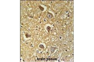 Immunohistochemistry (Paraffin-embedded Sections) (IHC (p)) image for anti-Hyaluronan Synthase 2 (HAS2) (AA 138-166) antibody (ABIN651874)