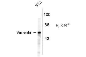 Image no. 1 for anti-Vimentin (VIM) antibody (ABIN372741) (Vimentin 抗体)