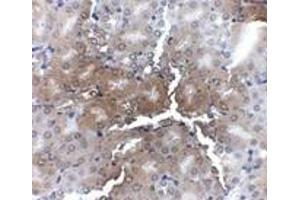 Immunohistochemistry of AP2M1 in mouse kidney tissue with AP2M1 antibody at 2. (AP2M1 抗体  (C-Term))