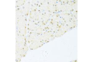 Immunohistochemistry of paraffin-embedded rat pancreas using NR1I2 antibody (ABIN5970763) at dilution of 1/100 (40x lens). (NR1I2 抗体)
