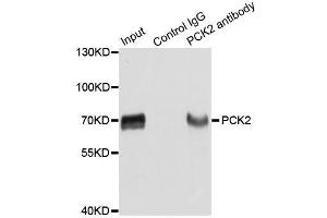 Immunoprecipitation analysis of extracts of HepG2 cells using PCK2 antibody. (PEPCK 抗体  (AA 1-280))