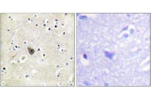 Immunohistochemistry analysis of paraffin-embedded human brain tissue, using PKD2 (Ab-876) Antibody. (PKD2 抗体  (AA 829-878))