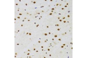 Immunohistochemistry of paraffin-embedded rat brain using CSRP3 Antibody (ABIN2562048) at dilution of 1:100 (40x lens). (CSRP3 抗体)