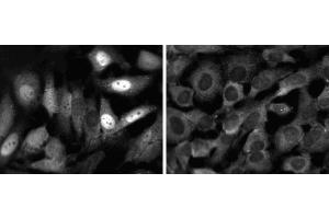 Immunofluorescent staining of HeLa (ATCC CCL-2) cells. (STAT1 抗体  (AA 592-731))