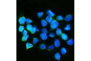 IF analysis of Calretinin/CALB2 using anti-Calretinin/CALB2 antibody (ABIN7603109).