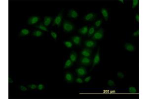 Immunofluorescence of monoclonal antibody to TRIM33 on HeLa cell. (TRIM33 抗体  (AA 1006-1105))
