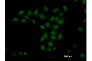 Immunofluorescence of monoclonal antibody to TRIM33 on HeLa cell. (TRIM33 抗体  (AA 1006-1105))