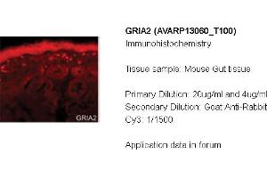 Immunohistochemistry (IHC) image for anti-Glutamate Receptor, Ionotropic, AMPA 2 (GRIA2) (N-Term) antibody (ABIN2792285) (GRIA2 抗体  (N-Term))