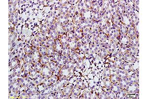 Formalin-fixed and paraffin embedded: rat kidney tissue labeled with Anti-GLUT4 Polyclonal Antibody (ABIN739445), Unconjugated at 1:200, followed by conjugation to the secondary antibody and DAB staining (GLUT4 抗体  (AA 401-509))