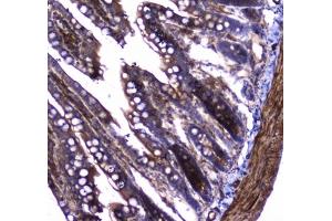 IHC testing of FFPE rat small intestine tissue with Dynamin 1 antibody at 1ug/ml.