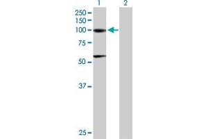 Western Blot analysis of ACO1 expression in transfected 293T cell line by ACO1 MaxPab polyclonal antibody. (Aconitase 1 抗体  (AA 1-889))