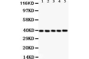 Anti- CXCR6 antibody, Western blottingAll lanes: Anti CXCR6  at 0.