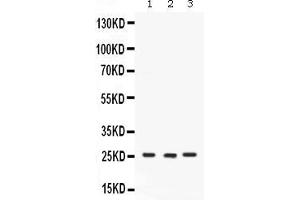 Western blot analysis of CACYBP expression in rat brain extract ( Lane 1), mouse testis extract ( Lane 2) and SW620 whole cell lysates ( Lane 3).