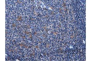 Immunohistochemical staining of paraffin-embedded Human lymph node tissue using anti-MICAL1 mouse monoclonal antibody. (MICAL1 抗体)