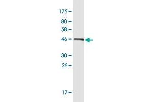 Western Blot detection against Immunogen (46. (m1ip1 抗体  (AA 1-183))
