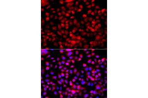 Immunofluorescence analysis of A549 cell using FASN antibody. (Fatty Acid Synthase 抗体)
