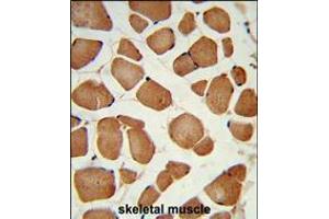 Formalin-fixed and paraffin-embedded human skeletal muscle reacted with ANGPTL4 Antibody , which was peroxidase-conjugated to the secondary antibody, followed by DAB staining.