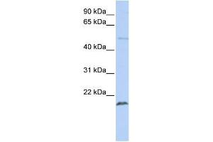 Human Jurkat; WB Suggested Anti-ZNF79 Antibody Titration: 0. (ZNF79 抗体  (N-Term))