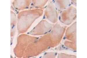Used in DAB staining on fromalin fixed paraffin- embedded Kidney tissue (SRPK3 抗体  (AA 220-506))