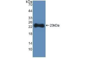 Detection of Recombinant HMGCS, Human using Polyclonal Antibody to Hydroxymethylglutaryl Coenzyme A Synthase (HMGCS) (HMGCS1 抗体  (AA 293-467))
