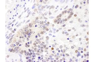 Immunohistochemistry (IHC) image for anti-Cullin 4B (CUL4B) (AA 863-913) antibody (ABIN7454566) (Cullin 4B 抗体  (AA 863-913))