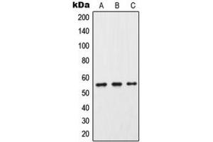 Western blot analysis of Cytochrome P450 2C9 expression in HeLa (A), Raw264. (CYP2C9 抗体  (Center))