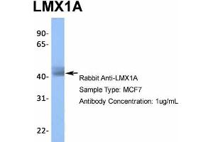 Host:  Rabbit  Target Name:  LMX1A  Sample Type:  MCF7  Antibody Dilution:  1. (LMX1A 抗体  (Middle Region))