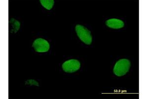 Immunofluorescence of purified MaxPab antibody to CHD2 on HeLa cell. (CHD2 抗体  (AA 1-501))
