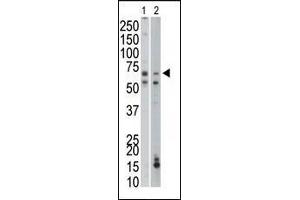 The anti-PCK1 Pab (ABIN1882180 and ABIN2842170) is used in Western blot to detect PCK1 in mouse liver (Lane 1) and mouse small intestine tissue lysates (Lane 2). (PCK1 抗体  (C-Term))