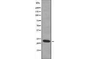 Western blot analysis of extracts from COLO cells, using MOL2B antibody. (MOBKL2B 抗体  (C-Term))