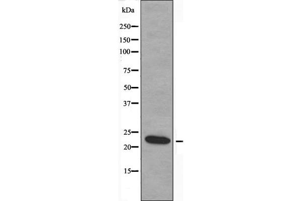 MOBKL2B 抗体  (C-Term)