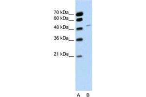 Western Blotting (WB) image for anti-RNA Binding Motif Protein 22 (RBM22) antibody (ABIN2462277) (RBM22 抗体)