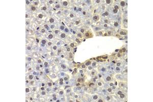 Immunohistochemistry of paraffin-embedded mouse liver using SUPT20H antibody (ABIN6133386, ABIN6148735, ABIN6148736 and ABIN6223233) at dilution of 1:100 (40x lens). (FAM48A/P38IP 抗体  (AA 580-779))