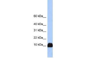 Profilin 1 antibody used at 1 ug/ml to detect target protein. (PFN1 抗体  (N-Term))