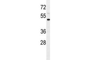 Western Blotting (WB) image for anti-Interleukin 1 Receptor, Type II (IL1R2) (AA 273-300) antibody (ABIN3031432)