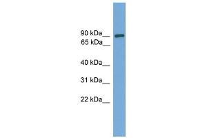 WB Suggested Anti-DEPDC1 Antibody Titration: 0. (DEPDC1 抗体  (Middle Region))
