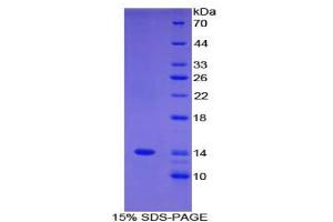 SDS-PAGE analysis of Human FAM19A3 Protein. (FAM19A3 蛋白)