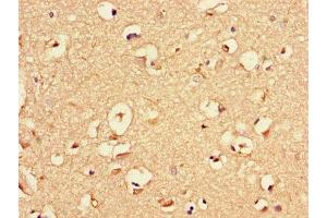 Immunohistochemistry of paraffin-embedded human brain tissue using ABIN7145523 at dilution of 1:100 (Nerve Growth Factor 抗体  (AA 122-218))
