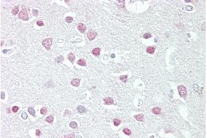 ABIN570929 (2. (MC5 Receptor 抗体  (N-Term))