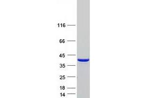 Western Blotting (WB) image for Calcium Binding Protein 39-Like (CAB39L) (Transcript Variant 1) protein (Myc-DYKDDDDK Tag) (ABIN2712998)