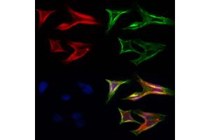 ABIN6264742 and ABIN6272414 staining Hela cells by IF/ICC. (RHOG 抗体  (Internal Region))