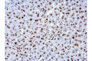 Immunohistochemistry (IHC) image for anti-Proliferating Cell Nuclear Antigen (PCNA) antibody (ABIN2854788)