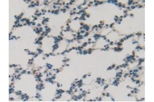 IHC-P analysis of Rat Lung Tissue, with DAB staining. (SFTPB 抗体  (AA 111-329))