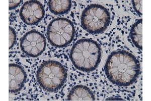 Immunohistochemical staining of paraffin-embedded Human Kidney tissue using anti-CRYM mouse monoclonal antibody. (CRYM 抗体)