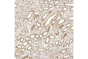 IHC analysis of SGCE using anti-SGCE antibody (ABIN7601544). (SGCE 抗体  (AA 38-407))